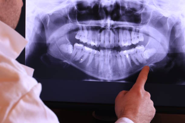 Best Broken or Cracked Tooth Emergency Dentist in Kulpsville, PA
